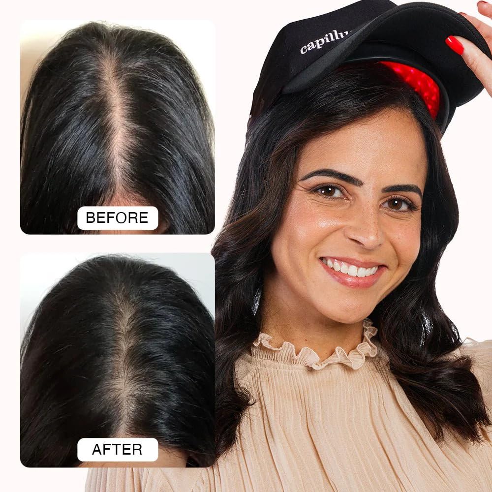 CapillusPro Clinical Hair Growth Laser Cap photo 2