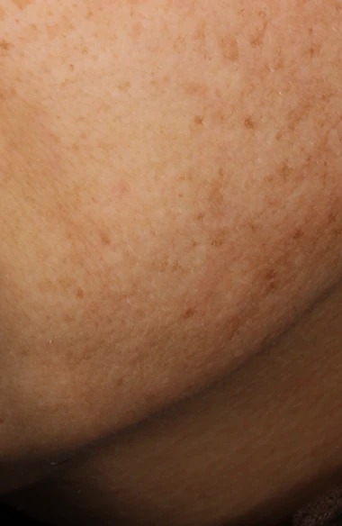 Foreo BEAR 2 Advanced Microcurrent Toning Device photo 2