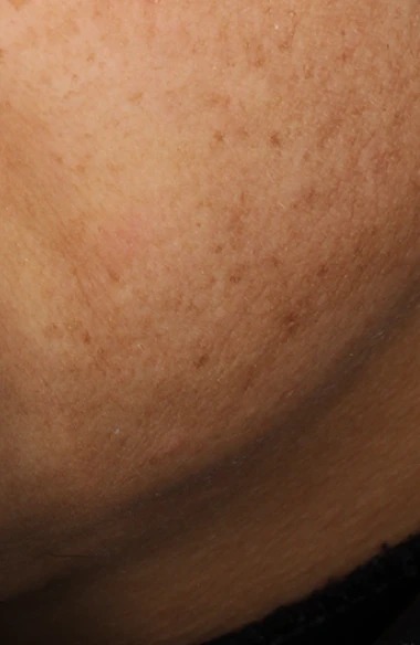 Foreo BEAR 2 Advanced Microcurrent Toning Device photo 5