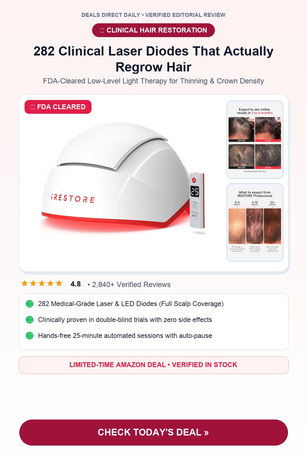 iRestore Professional Laser Hair Growth Helmet Pinterest Pin Creative