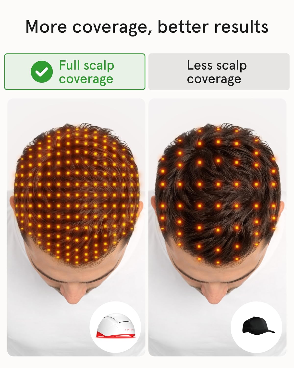 iRestore Professional Laser Hair Growth Helmet photo 4
