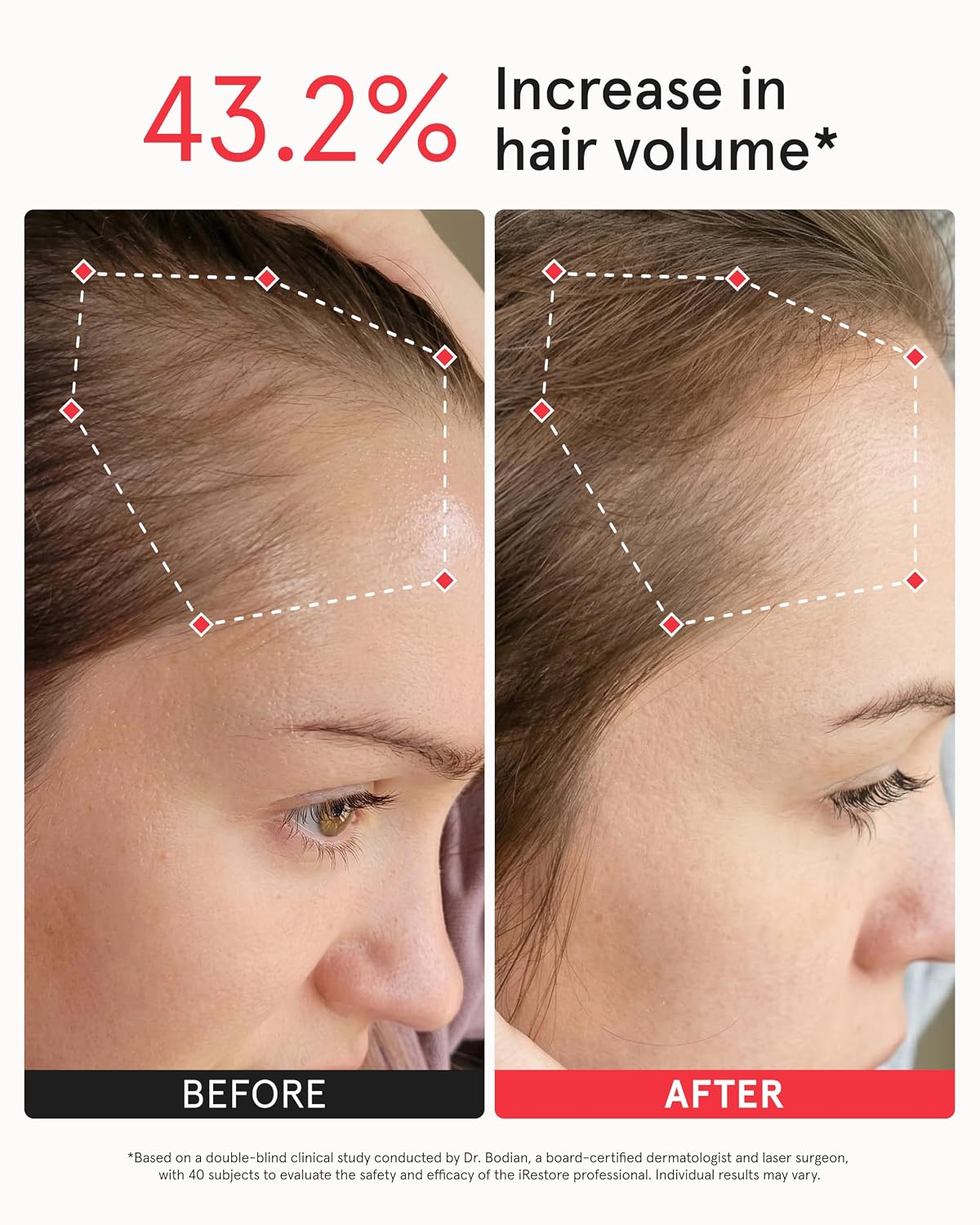 iRestore Professional Laser Hair Growth Helmet photo 5