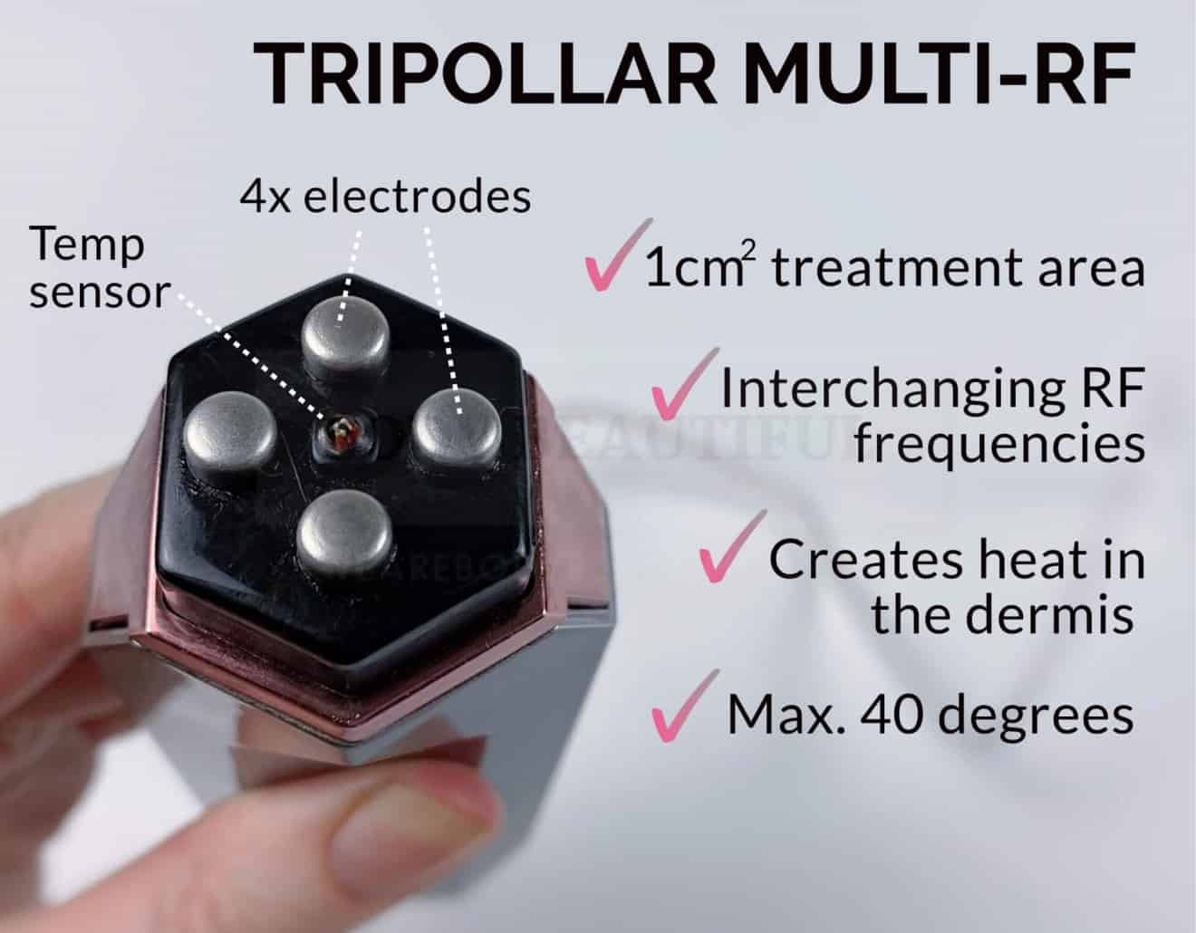 TriPollar STOP Vx Facial RF Skin Tightening Device photo 6